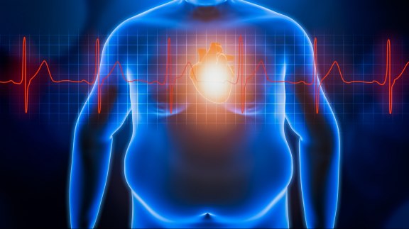 Obésité : un fléau XXL nourri par les inégalités socio-économiques image